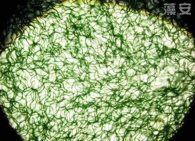 螺旋藻對(duì)于患有便秘的人,具有奇效